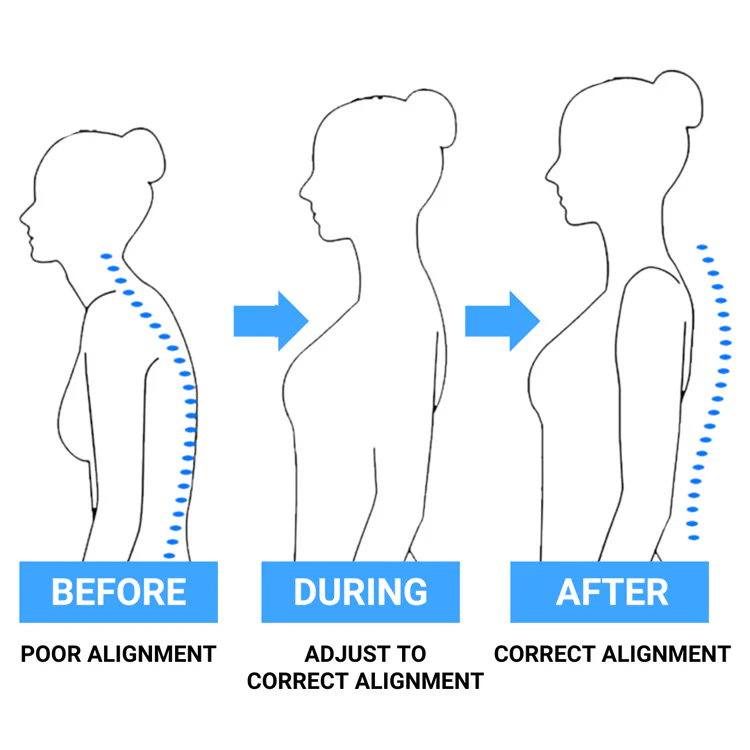 Posture transformation